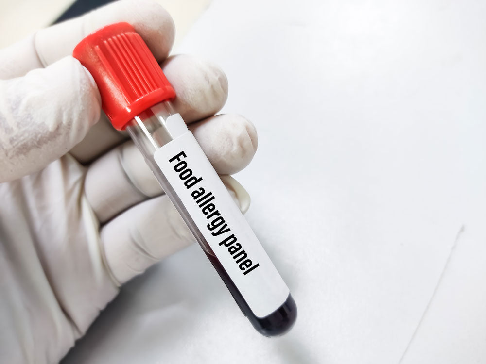 Food Allergy Profile