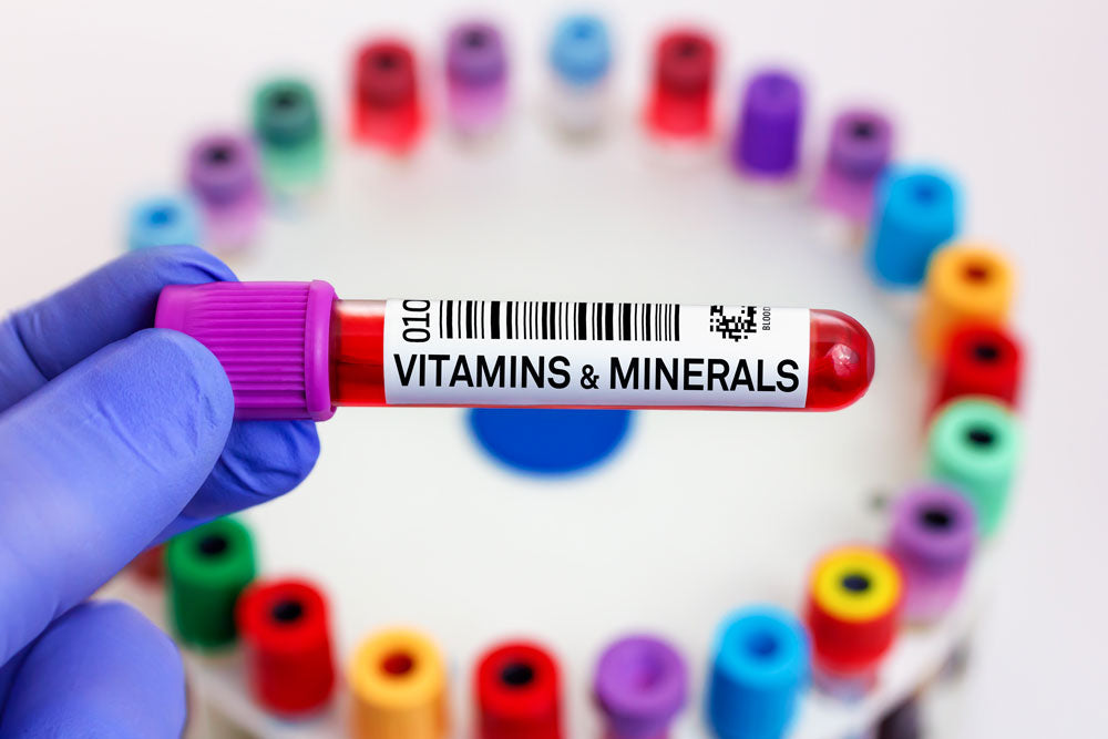 Vitamin/Mineral Tests for B12, Magnesium, Iron and Methylfolate